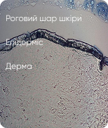 Мікропори в роговому шарі підвищують проникнення космецевтичних засобів - фото